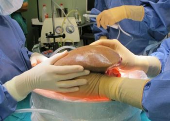 Más de 4.000 pacientes renales esperan por un trasplante de riñón en la República Dominicana 