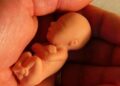 defesa aborto onu telemedicina 960x540 1 Bajarán a 15 años la edad para abortar sin consentimiento paterno en Dinamarca