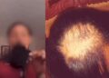 IMG 20230619 WA0135 Fiscalía solicitará prisión contra adolescente que le arrancó el pelo a otra en La Vega