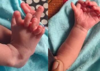Nace bebe con 26 dedos en el Norte de India; padres creen que es la reencarnación de una Diosa