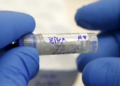 Zika Virus Científicos infectan a voluntarios con Zika en busca de vacunas y tratamientos
