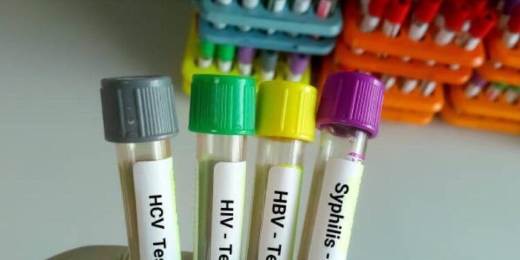 OMS alerta sobre aumento de casos de infecciones de transmisión sexual