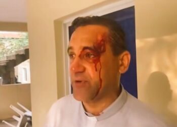 Sacerdote resulta herido durante operativo militar en Cotuí; responsabiliza a Abinader
